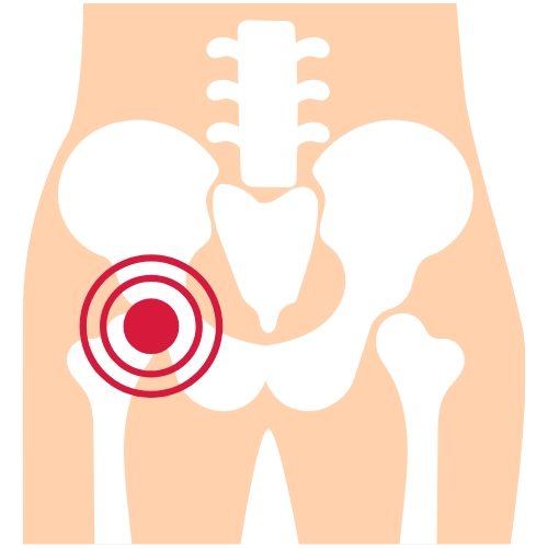 Traumatología en Mazatlán