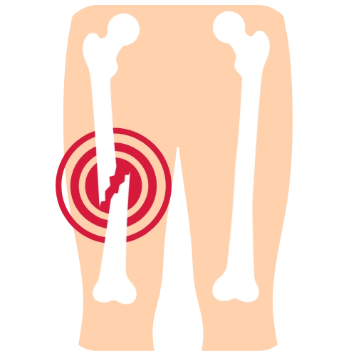 Traumatología en Mazatlán