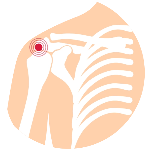 Traumatología en Mazatlán