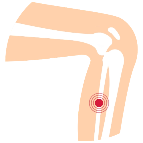 Traumatología en Mazatlán